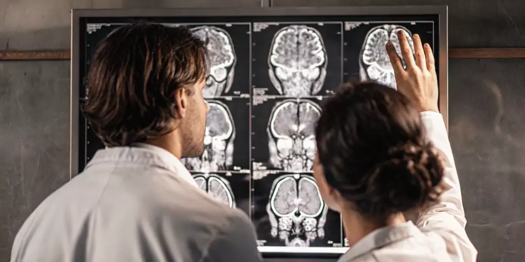 Doctors analyzing a brain scan to monitor if TMS is making OCD symptoms worse.